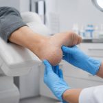 Pękające pięty mogą wynikać z suchości skóry, ucisku, źle dobranych butów, cukrzycy lub chorób skóry. Zobacz, jak pielęgnować stopy, kiedy iść do lekarza i czego nie robić.